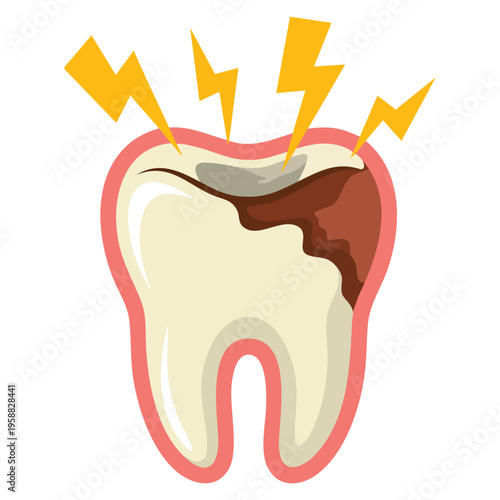 Vector illustration tooth cavity dental caries isolated suitable for oral health dentistry education awareness concept and medical design projects