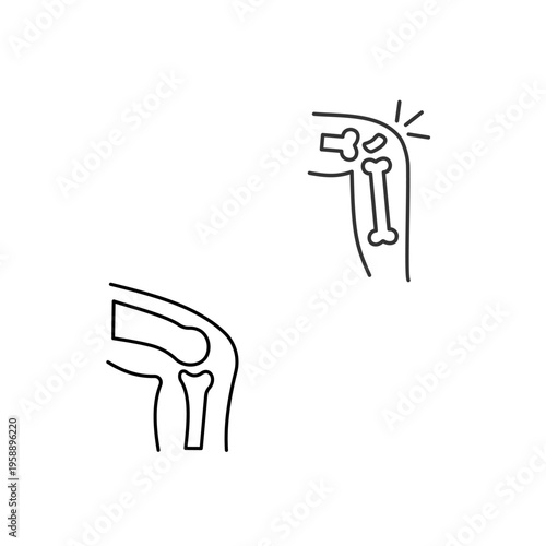 Knee Joint Pain Medical Illustration Human Leg Anatomy Line Design