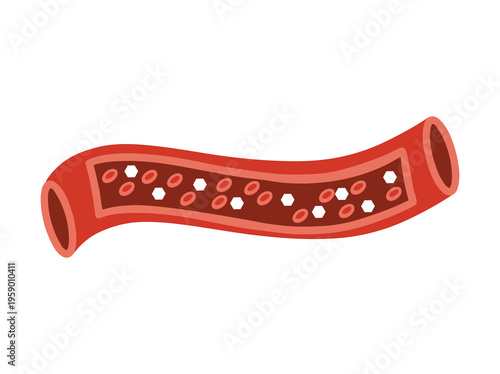 Diabetes Disease or Glucose in Blood Vessels