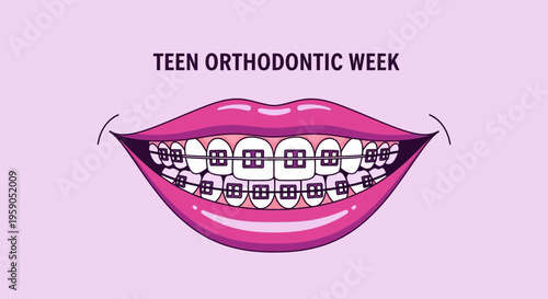Smiling Mouth With Teeth Braces and Teen Orthodontic Week Graphic Design