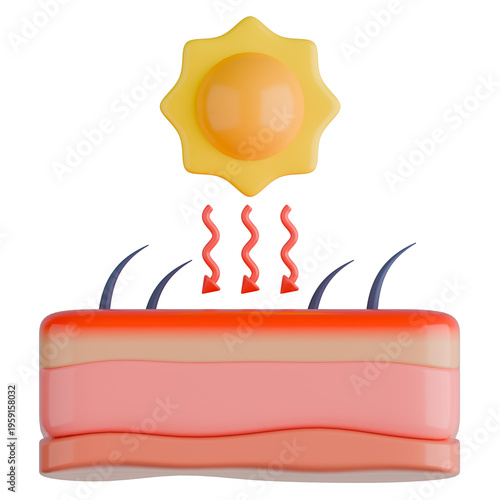 3D Sunburn Skin Layer with UV Rays Illustration.