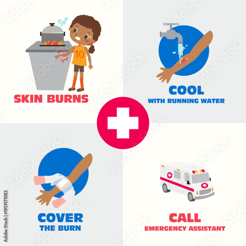 First Aid for Skin Burns Infographic Showing Cool with Water Cover the Burn and Call Emergency Assistant Procedure