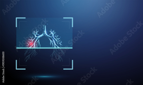 Human lungs inside digital scanning frame with red spot indicating abnormal area Pulmonary examination, disease detection, tumor identification, inflammation screening concept