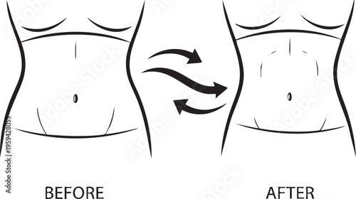 Silhouette of woman's stomach before and after weight loss body shape