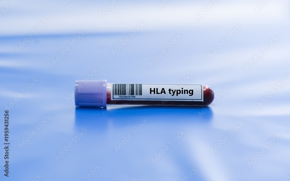 Fototapeta premium Blood sample tube for HLA typing test analysis.