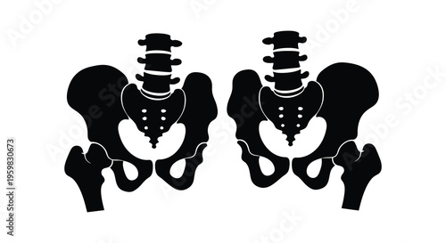 Two human pelvises depicted in a stark black silhouette
