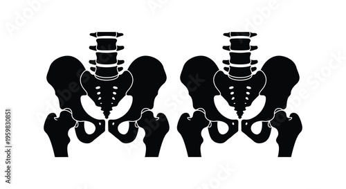 Two human pelvises displayed as a stark black silhouette
