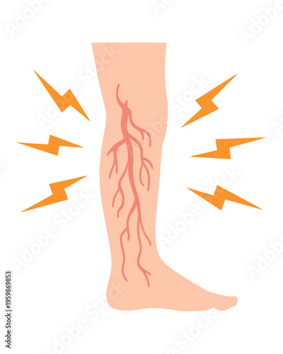 Anatomy of a human leg with visible veins and lightning bolts  health concept