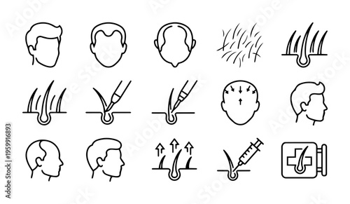 Hair Transplant Procedure Line Icons Set – Hair Loss, Follicle Extraction, Implantation and Regrowth Outline Collection