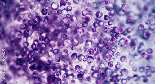 Microscopic identification of blast cells in marrow aspirate for leukemia knowledge