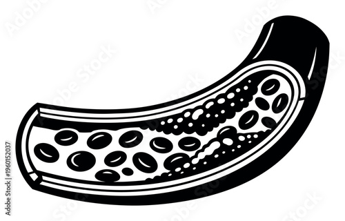 Artery cross-section showing blood cells flowing with a plaque buildup on one side, depicting cardiovascular disease