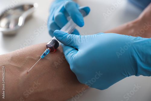 Canvastavla Nurse drawing man's blood sample in clinic, closeup