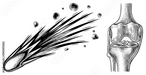 Celestial body colliding with Earth, debris trail, medical joint structure, skeletal diagram, black ink vector, scientific illustration, biomechanics study.