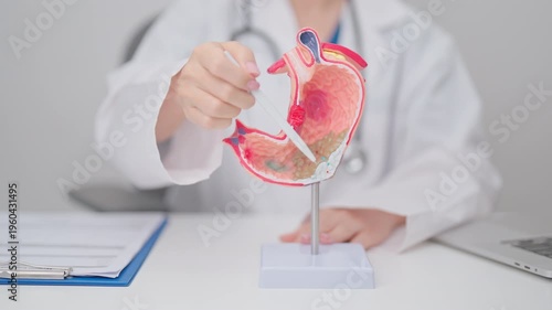 Doctor with Gastric anatomy model. Gastroenterologist consultation, stomach diseases and ulcers, November stomach cancer, Gastroesophageal Reflux Disease, GERD, Acid reflux and healthcare medical