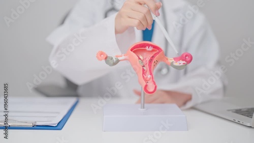 Doctor with Uterus and Ovaries anatomy model. Ovarian and Cervical cancer, Cervix disorder, Endometriosis, Hysterectomy, Uterine fibroids, Reproductive system, Pregnancy and health concept