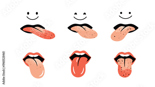 Educational medical illustration set showing different conditions and textures of the human tongue including bumps, spots, and color changes.