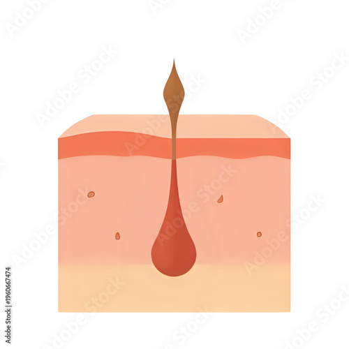 Anatomical illustration of a skin cross-section showing a hair follicle and sebaceous gland in detail.