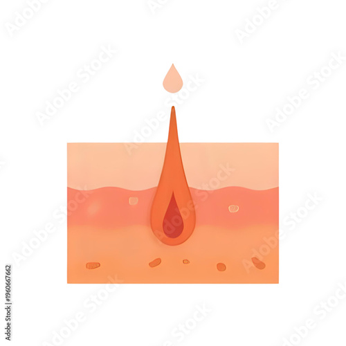 The 172.svg illustration shows a single drop of sweat emerging from a pore on human skin.