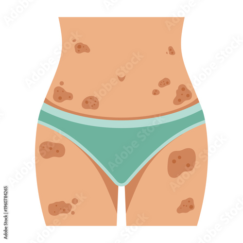 Vector of a woman's lower body with skin pigmentation