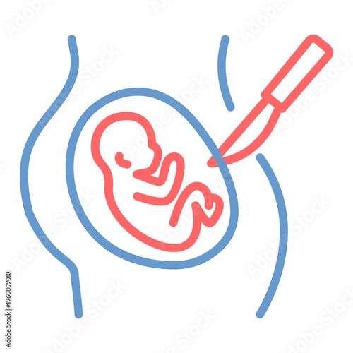 Cesarean Section Vector Icon