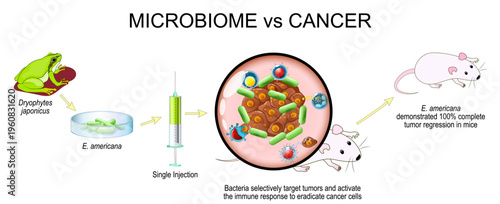 Microbiome and cancer. Cancer therapy. Experimental oncology.