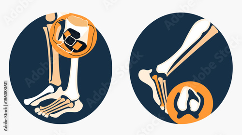 Stylized medical illustration of human foot skeleton, with inset details in vibrant, contrasting colors