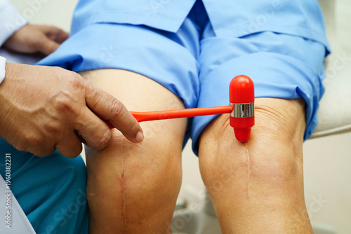 Tableau sur toile Asian doctor knock on knee reflex nerve for check and treatment senior patient in hospital