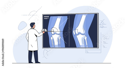 Doctor analyzing knee x-ray on screen, medical diagnosis and orthopedic treatment concept
