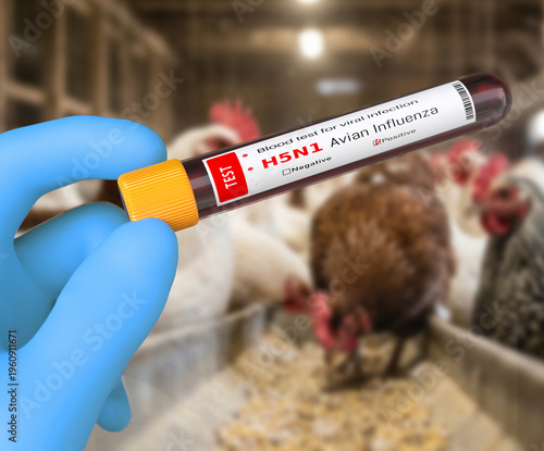 Doctor with blue glove holds a blood test tube for Avian influenza virus test