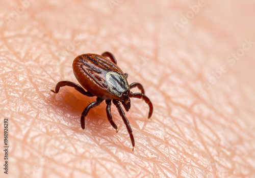 Garrapata sobre piel humana en primer plano macro, parasito peligroso para personas perros y mascotas, transmisor de enfermedades como Lyme, concepto de salud