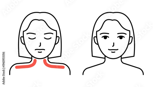 Woman with muscle neck pain and shoulder pain, suffering from discomfort. Medical problem, injury, or symptom concept for healthcare. Vector illustration