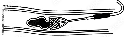 Medical device in a biological vessel