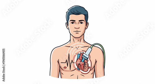 Medical illustration of a person undergoing a heart ultrasound examination