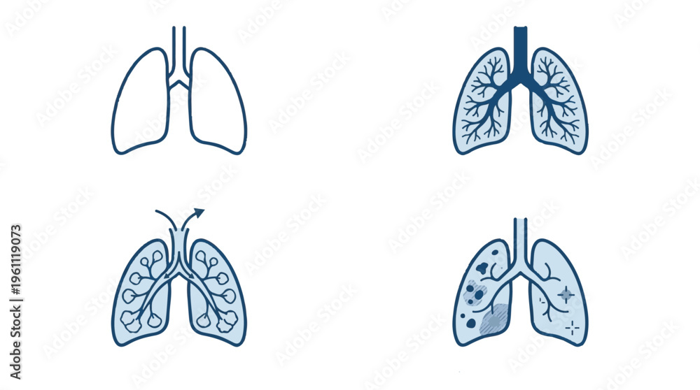 Obraz premium Human Lung Anatomy Icons Set Showing Healthy and Diseased States