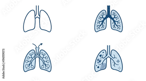 Human Lung Anatomy Icons Set Showing Healthy and Diseased States