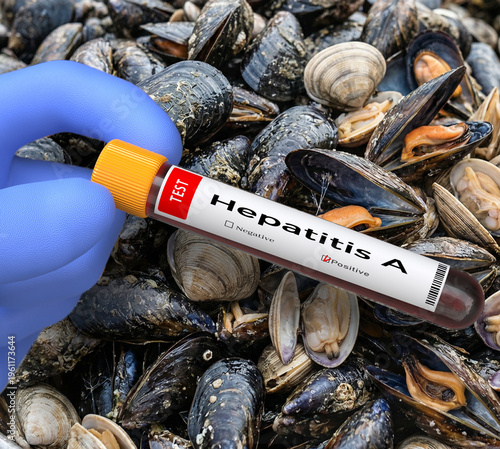 Doctor with gloves holds a test tube with a blood test for hepatitis A. Background of mussels and clams