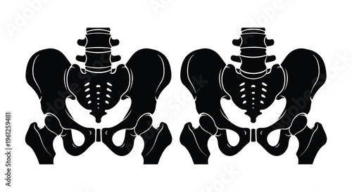 Two human pelvises displayed in a stark black silhouette