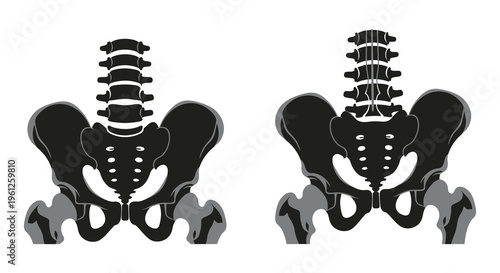 Anatomical illustration comparing male and female pelvic structures silhouette