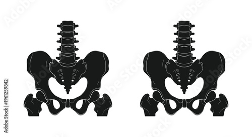 Anatomical illustration of human pelvis bones in black silhouette