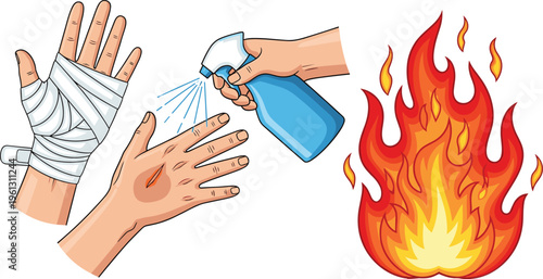 Hand Drawn Burn Injury First Aid and Fire Safety Vector Set Featuring Medical Bandage Soothing Spray and Flame for Health and Safety Graphic Designs