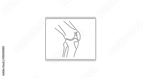 Detailed anatomical line illustration showcasing the essential structure of a human knee joint