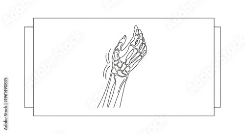 Human skeletal hand anatomy illustration showing wrist joint movement or pain concept