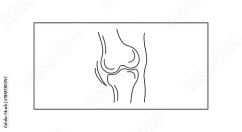 Detailed line drawing illustrating the complex human knee joint structure and associated bones