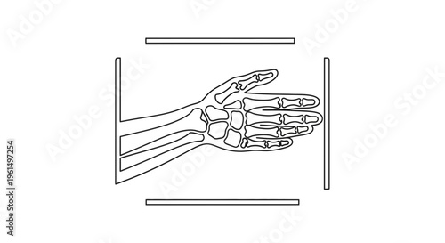 Minimalist continuous line art illustration showing a human hand skeleton undergoing an X-ray