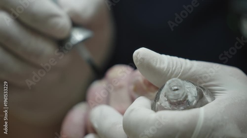 Podiatrist treating fungal toenail infection with drill