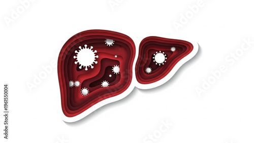 World Hepatitis Day Conceptual illustration of a diseased human liver affected by viral infection, depicting the impact of pathogens on internal organ health and biological processes