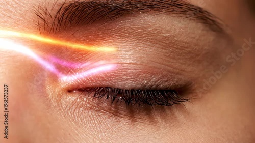 Laser Eye Surgery A CloseUp Look at Vision Correction.