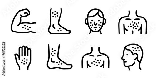 A collection of line art icons representing various common human skin conditions and body rashes Vector