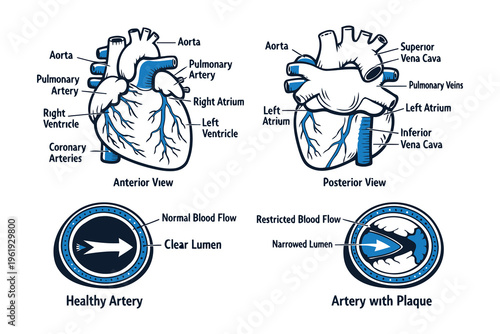 Anatomical diagrams of the human heart and a comparison between healthy and blocked arteries Vector