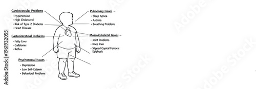 A medical infographic illustrating the various health consequences associated with childhood obesity Vector